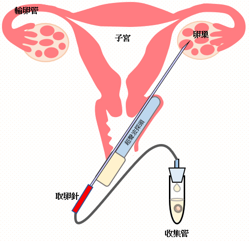 FrvDomMNL517VgjeUIMcCBTFUh9-